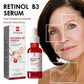Concentrated Retinol & Vitamin Complex Serum 30Ml